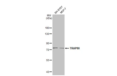 Anti-TRAP80 antibody [C1C3] used in Western Blot (WB). GTX115241