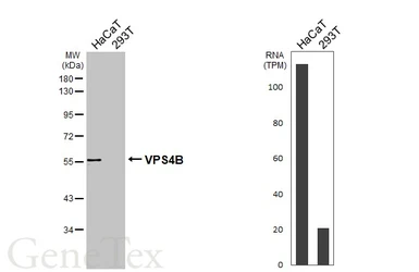 Anti-VPS4B antibody [N3C3] used in Western Blot (WB). GTX115249