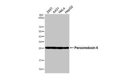 Anti-Peroxiredoxin 6 antibody used in Western Blot (WB). GTX115262