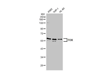 Anti-TOX antibody [N1C1] used in Western Blot (WB). GTX115287
