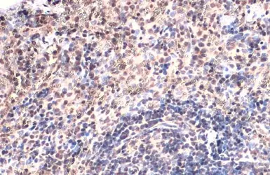 Anti-TOX antibody [N1C1] used in IHC (Paraffin sections) (IHC-P). GTX115287