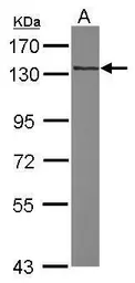 Anti-RNF40 antibody [N1N2], N-term used in Western Blot (WB). GTX115295