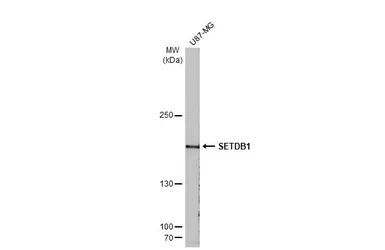 Anti-SETDB1 antibody [N1], N-term used in Western Blot (WB). GTX115305