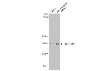 Anti-SETDB1 antibody [N1], N-term used in Western Blot (WB). GTX115305