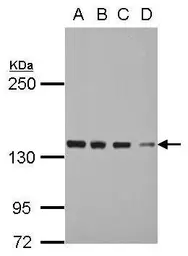 Anti-DDX46 antibody [C2C3], C-term used in Western Blot (WB). GTX115308