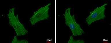 Anti-ACTR1B antibody used in Immunocytochemistry/ Immunofluorescence (ICC/IF). GTX115347