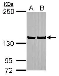 Anti-LRP130 antibody [N2N3] used in Western Blot (WB). GTX115351