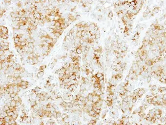 Anti-Syntaxin 6 antibody [N1C3] used in IHC (Paraffin sections) (IHC-P). GTX115375