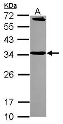 Anti-Syntaxin 6 antibody [N1C3] used in Western Blot (WB). GTX115375