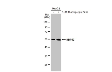 Anti-NDP52 antibody used in Western Blot (WB). GTX115378
