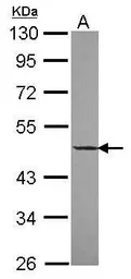 Anti-DNAJA2 antibody [N1C2] used in Western Blot (WB). GTX115393
