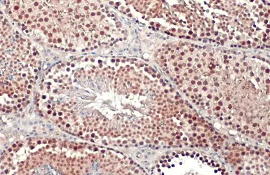 Anti-PRMT5 antibody [N3C3] used in IHC (Paraffin sections) (IHC-P). GTX115409