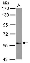 Anti-DEAF1 antibody [N2C2], Internal used in Western Blot (WB). GTX115430