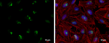 Anti-RNAse H2A antibody used in Immunocytochemistry/ Immunofluorescence (ICC/IF). GTX115433