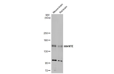 Anti-NTE antibody used in Western Blot (WB). GTX115501