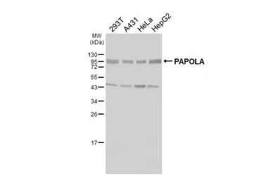 Anti-PAPOLA antibody used in Western Blot (WB). GTX115503