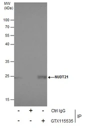 Anti-NUDT21 antibody used in Immunoprecipitation (IP). GTX115535