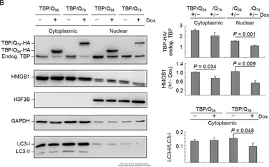Anti-Histone H3.3B antibody used in Western Blot (WB). GTX115549