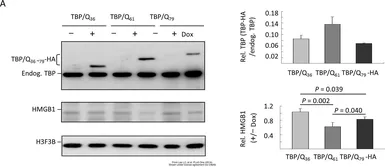 Anti-Histone H3.3B antibody used in Western Blot (WB). GTX115549