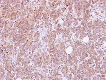 Anti-ANKHD1 antibody [N1], N-term used in IHC (Paraffin sections) (IHC-P). GTX115568