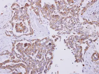 Anti-Cpn10 antibody used in IHC (Paraffin sections) (IHC-P). GTX115575