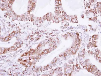 Anti-LDB3 antibody used in IHC (Paraffin sections) (IHC-P). GTX115593