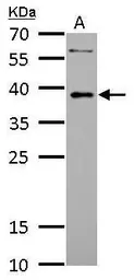 Anti-LDB3 antibody used in Western Blot (WB). GTX115593