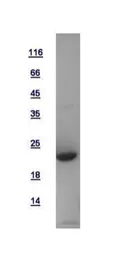 Human DCTN3 protein, His tag. GTX115607-pro
