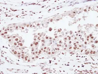 Anti-U2AF65 antibody [C1C3] used in IHC (Paraffin sections) (IHC-P). GTX115622