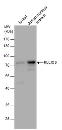 Anti-HELIOS antibody [N3C3] used in Western Blot (WB). GTX115629