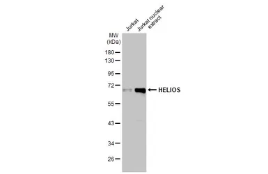 Anti-HELIOS antibody used in Western Blot (WB). GTX115630