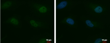 Anti-MTF2 antibody used in Immunocytochemistry/ Immunofluorescence (ICC/IF). GTX115635