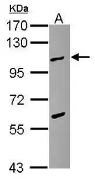 Anti-TPX2 antibody used in Western Blot (WB). GTX115654