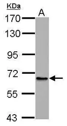 Anti-ABCB10 antibody used in Western Blot (WB). GTX115704