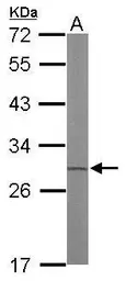 Anti-ETHE1 antibody used in Western Blot (WB). GTX115707
