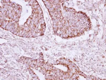 Anti-ACOT9 antibody [N1C1] used in IHC (Paraffin sections) (IHC-P). GTX115724