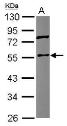 Anti-Coronin 1C antibody [C1C3] used in Western Blot (WB). GTX115727