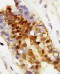 Anti-Hsp70 antibody used in IHC (Paraffin sections) (IHC-P). GTX11573