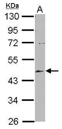 Anti-EML2 antibody [N1N3] used in Western Blot (WB). GTX115761