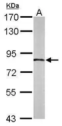 Anti-APPL1 antibody [C1C3] used in Western Blot (WB). GTX115787