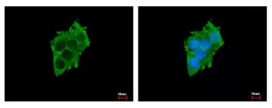 Anti-SLC17A5 antibody used in Immunocytochemistry/ Immunofluorescence (ICC/IF). GTX115822