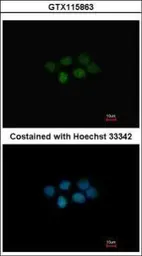 Anti-MAT2B antibody [N3C3] used in Immunocytochemistry/ Immunofluorescence (ICC/IF). GTX115863