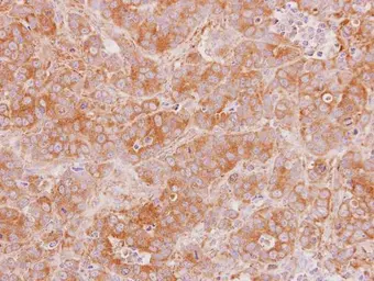 Anti-NKIRAS2 antibody [N1C3] used in IHC (Paraffin sections) (IHC-P). GTX115867