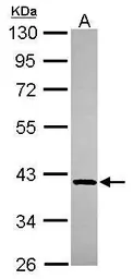 Anti-GMPPB antibody [N1C1] used in Western Blot (WB). GTX115902