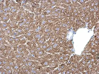 Anti-PSAT1 antibody [N3C3] used in IHC (Paraffin sections) (IHC-P). GTX115909