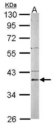 Anti-PSAT1 antibody [N3C3] used in Western Blot (WB). GTX115909