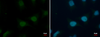 Anti-Histone H2B antibody used in Immunocytochemistry/ Immunofluorescence (ICC/IF). GTX115955