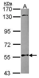 Anti-NMT2 antibody used in Western Blot (WB). GTX115976
