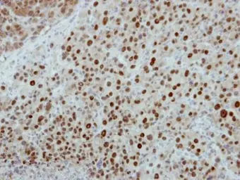 Anti-POLR1D antibody [N1C3] used in IHC (Paraffin sections) (IHC-P). GTX115993