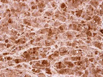 Anti-PRMT5 antibody [N1C1] used in IHC (Paraffin sections) (IHC-P). GTX116004